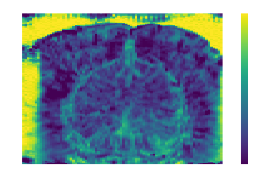 tSNR spatial map